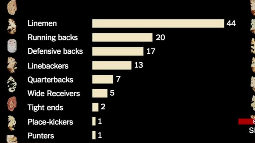 Study: Football causes brain damage_00022719.jpg