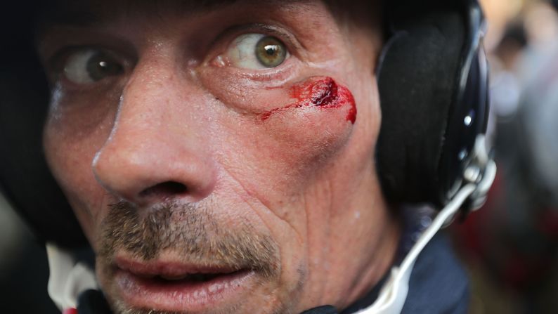 A white nationalist is seen with a cut below his eye suffered during clashes with counterprotesters at Emancipation Park .