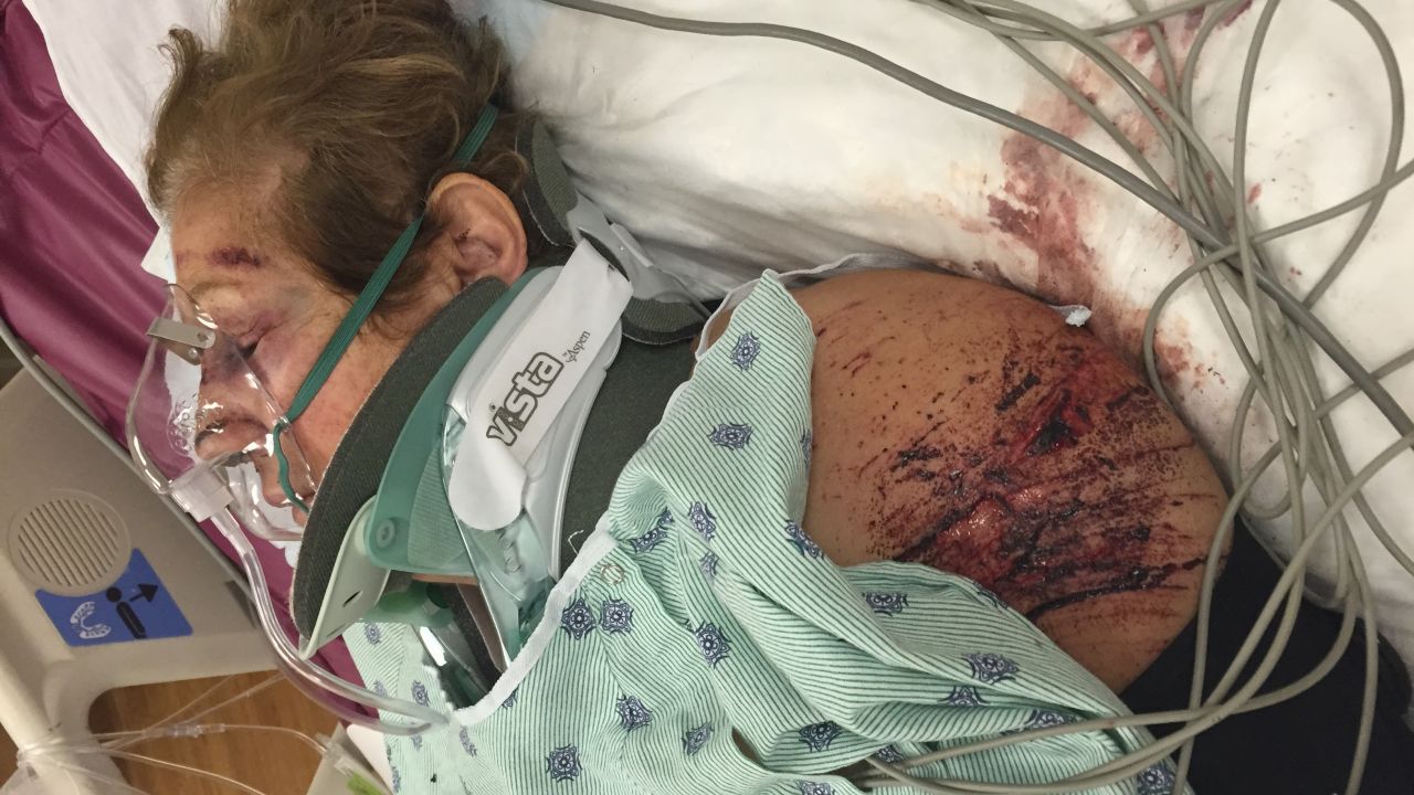 A severely injured Haifa Jabara lies in the ICU the day after she is hit by a car.