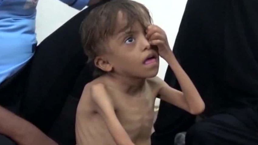 thousands of children at risk yemen kinkade pkg_00001103.jpg