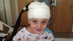 Madison Jensen was diagnosed and treated for autoimmune encephalitis.