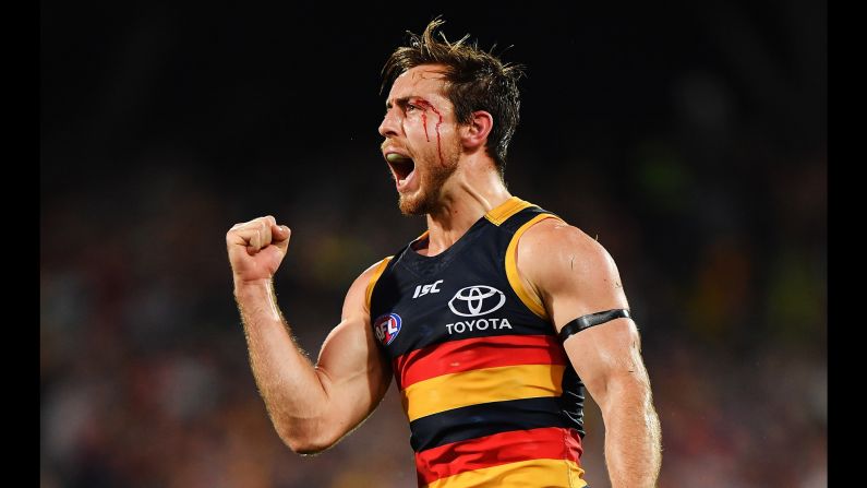 A bloodied Richard Douglas celebrates after kicking a goal during an Australian Football League match on Thursday, September 7. Douglas and the Adelaide Crows defeated the Greater Western Sydney Giants to clinch a spot in the AFL's preliminary finals.