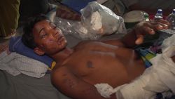 rohingya injured alex field lklv_00005910.jpg