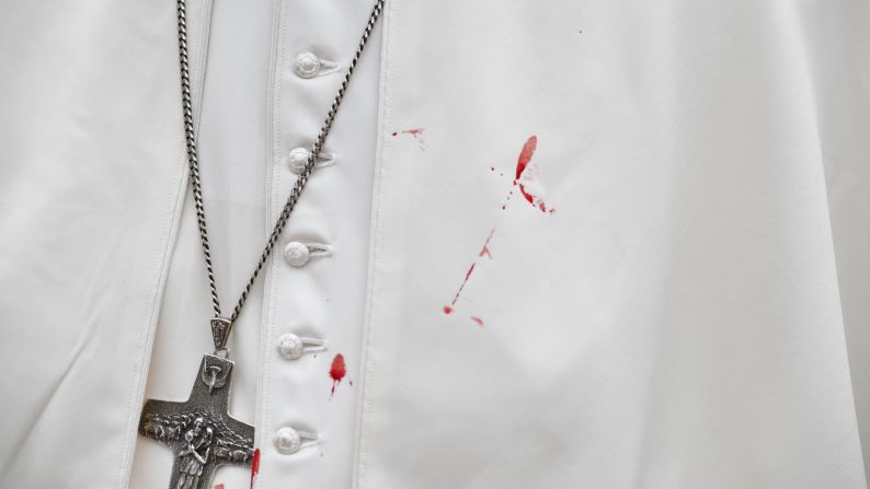 Blood stains Pope Francis' cassock Sunday, September 10, after he accidentally hit his head on his Popemobile in Cartagena, Colombia. Vatican spokesman Greg Burke said the Pope was bruised but OK. <a href="http://www.cnn.com/2017/09/07/americas/gallery/pope-francis-colombia-visit/index.html" target="_blank">See photos from the Pope's five-day visit to Colombia</a>
