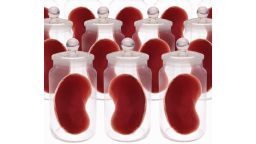 Spare kidneys. Conceptual computer artwork of spare kidneys stored in jars. This may represent the growth of human tissue to produce material for transplant surgery to replace defective or old body parts. This technology may develop from work on stem cells or research into cloning. The image may also represent the transplantation of animal organs to humans (xenotransplantation).