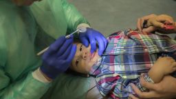 Ray Stewart, a pediatric dental professor at the University of California-San Francisco, examines Matthew Mai, 2, of Vallejo, Calif., at UCSF Benioff Children's Hospital San Francisco on Sept. 11, 2017. He emphasizes to parents of his young patients that dental decay is an infectious disease, so they should avoid sharing utensils with their kids. (Robert Durell for Kaiser Health News)