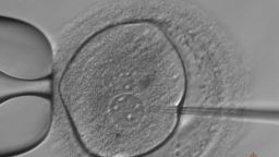 01 UK gene editing embryos fertility study