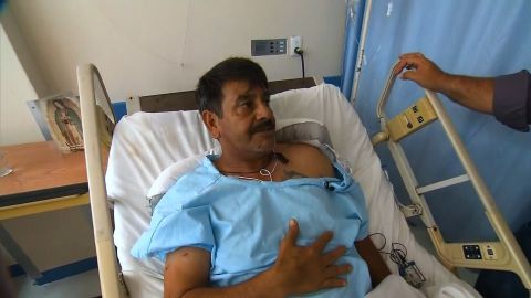Mendez is recovering at a hospital after suffering a broken leg in this week's collapse.