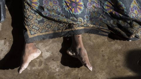 The body of a Rohingya refugee who died when the boat capsized was covered before the funeral. (Fred Dufour/AFP/Getty Images)