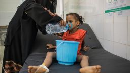 August 28, 2017 -- Fatima Yasen Ibrahim is treated for cholera at IRC-supported Al Sadaqa Hospital in Aden, Yemen. Yemen is currently experiencing the largest cholera outbreak in history. Due to the ongoing conflict in Yemen, health facilities and infrastructure have been broken down. Many people struggle to find access to clean water and sanitary bathroom facilities. The IRC is responding to the cholera outbreak in Yemen by providing clean water, running diarrhea treatment centers where cholera patients are treated, and educating local communities on how to prevent cholera.