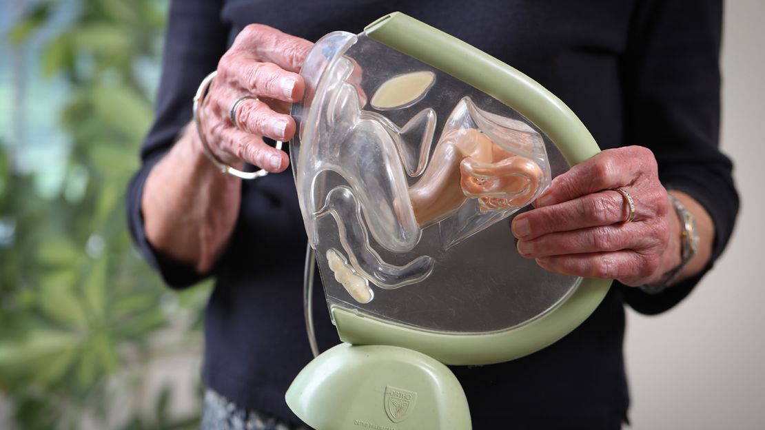 Dona Wells shows a model of the female reproductive system used in explaining abortion procedures.