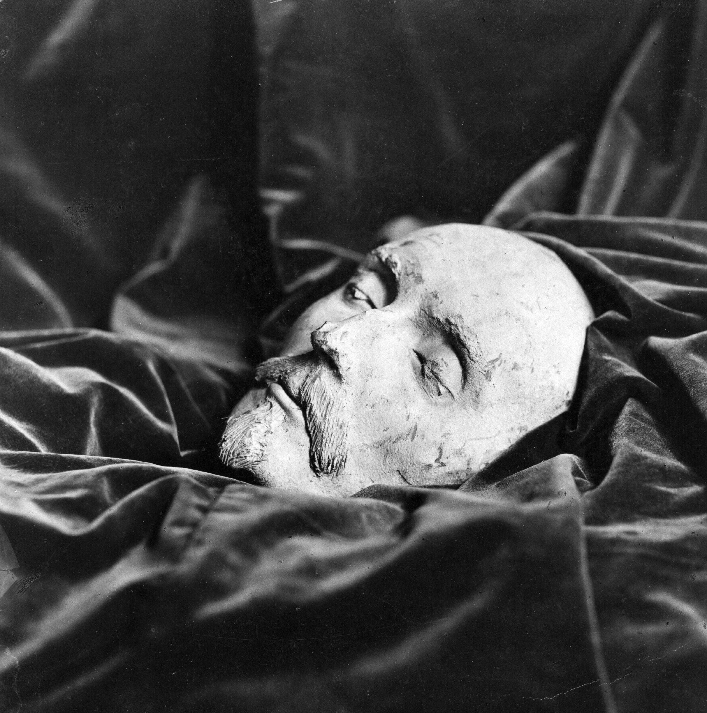 dead celebrities morgue photos