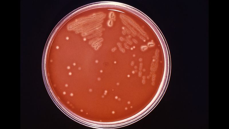 CDC Warns Doctors To Be On Alert For Cases Of Flesh-eating Bacteria ...