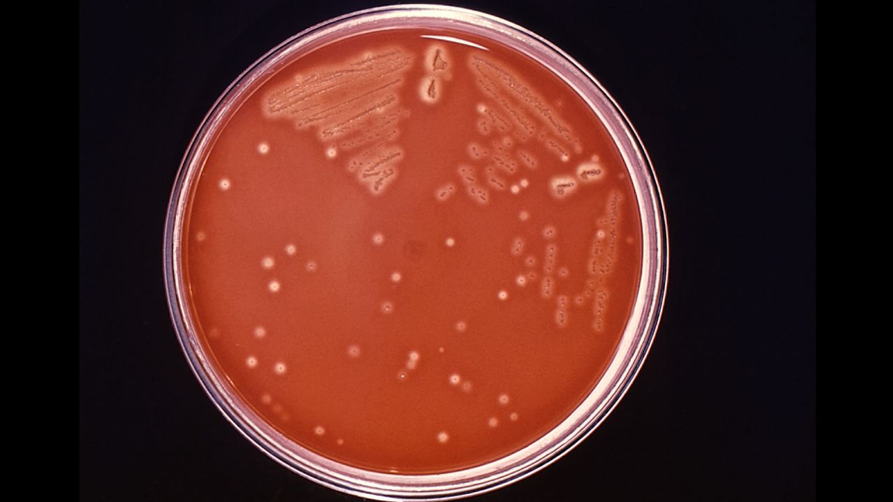 flesh eating bacteria