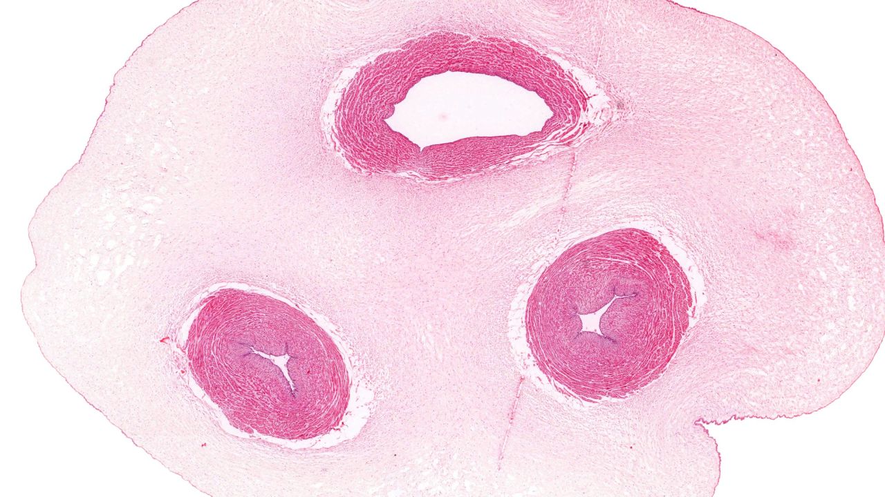 A cross-section of an umbilical cord
