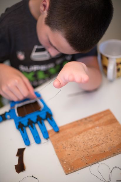 The e-NABLE designs are simple enough that children can build them. Over the past year and a half over 2,000 schools and robotics teams have participated in creating hands.