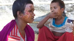 Rohingya refugee Mumtaz and her seven-year-old daughter Razia. 