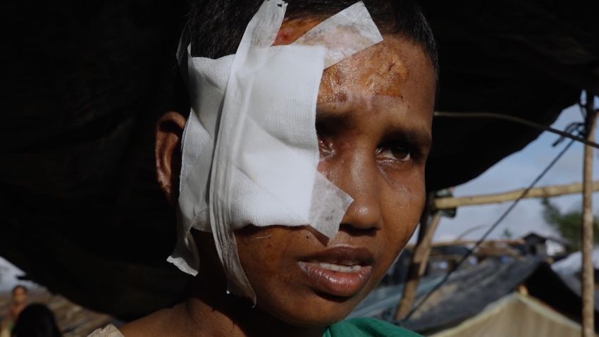 Survivors of an alleged massacre of Rohingya Muslims at Tula Toli village in Myanmar in August 2017