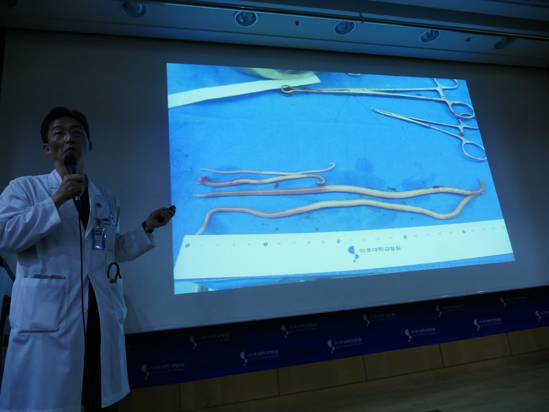 Slides show intestinal worms, some as long as 27 centimeters, removed from the defector.