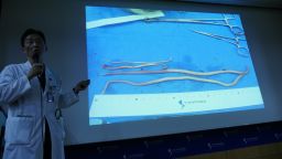 Slides show the intestinal worms, some as long as 27 centimeters, which were removed from the North Korean defector