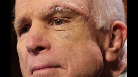 McCain returned to the Senate floor in July 2017, less than two weeks after surgeons removed a large blood clot from his brain and diagnosed him with brain cancer. He received a standing ovation on both sides of the aisle. 