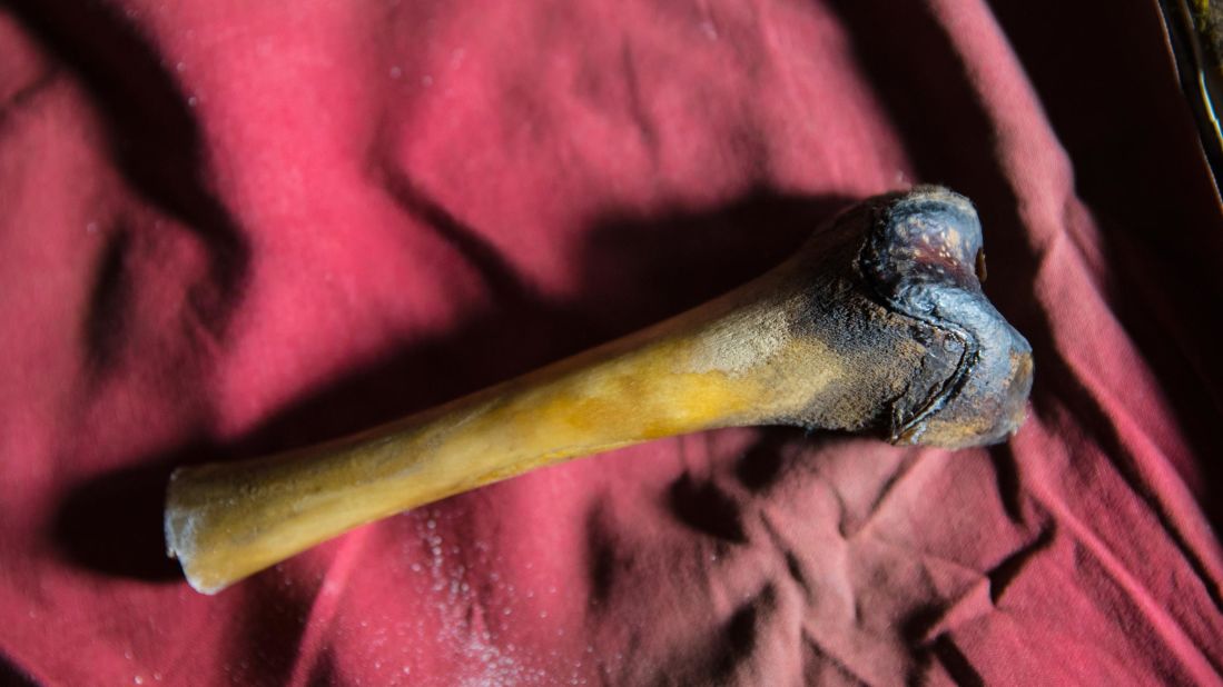 A femur bone from the decayed body of a purported Yeti was found in a cave in Tibet. Biologist Charlotte Lindqvist tested DNA from the bone for Icon Films' "Yeti or Not" TV special. The bone was from a Tibetan brown bear.