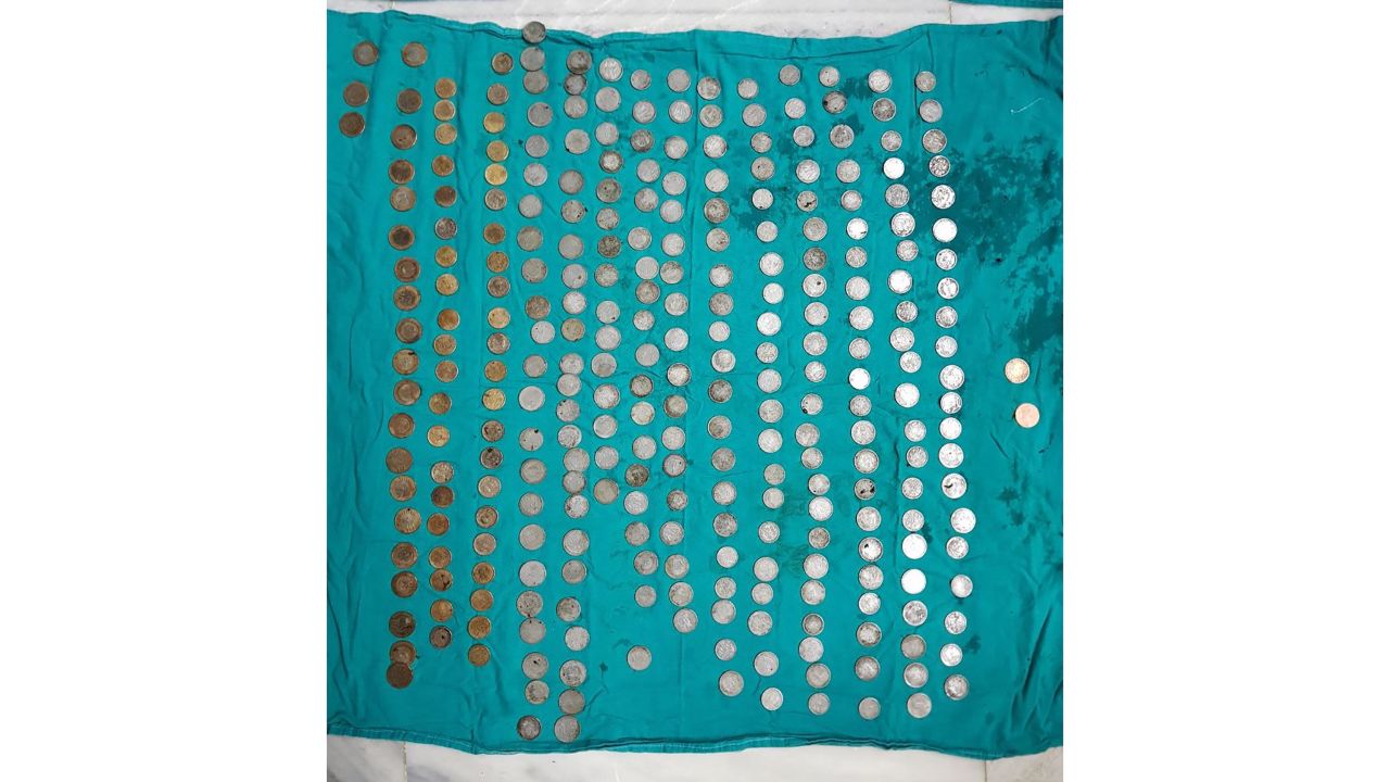 Doctor's say 263 coins were removed from Maksood Khan's stomach.