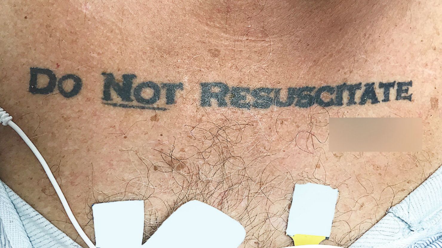 A man admitted to a Florida hospital had an unusual do not resuscitate order, a new study shows.