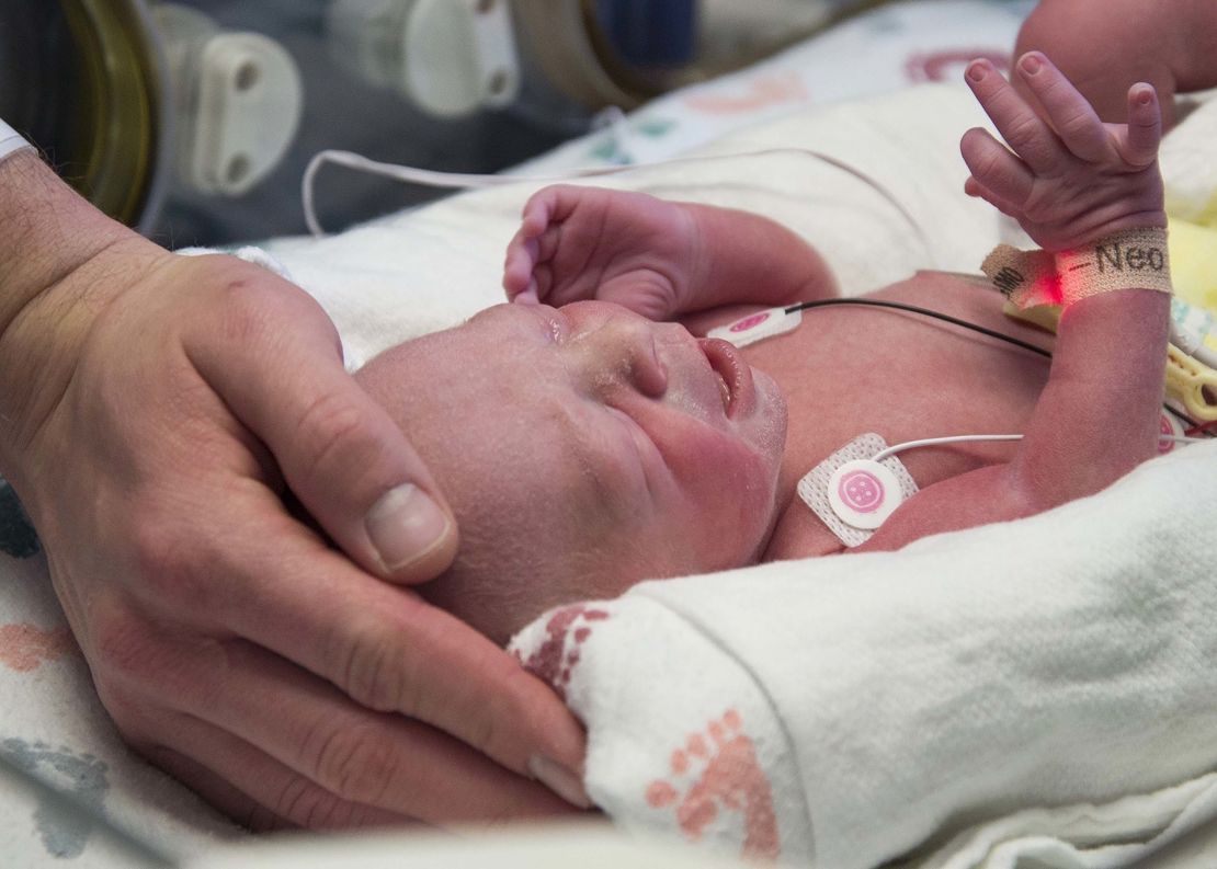 The first baby born as a result of a womb transplant in the United States lies in the neonatal unit at Baylor University Medical Center in Dallas.