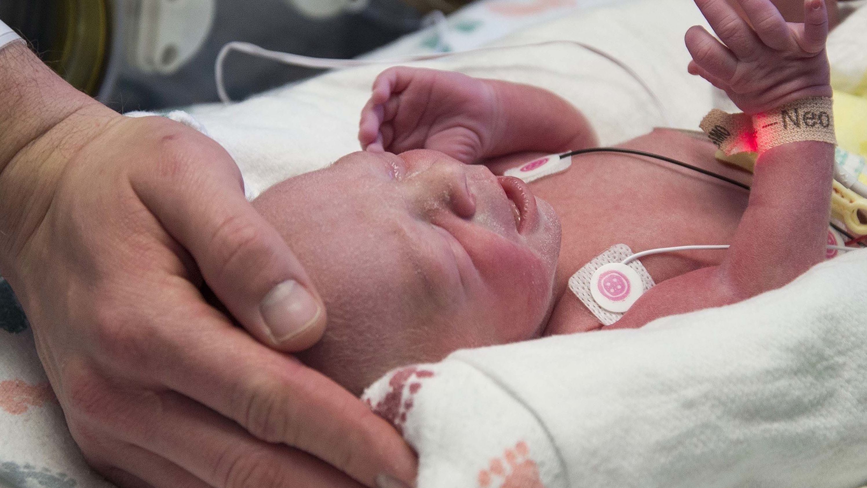The first baby born as a result of a womb transplant in the United States lies in the neonatal unit at Baylor University Medical Center in Dallas.