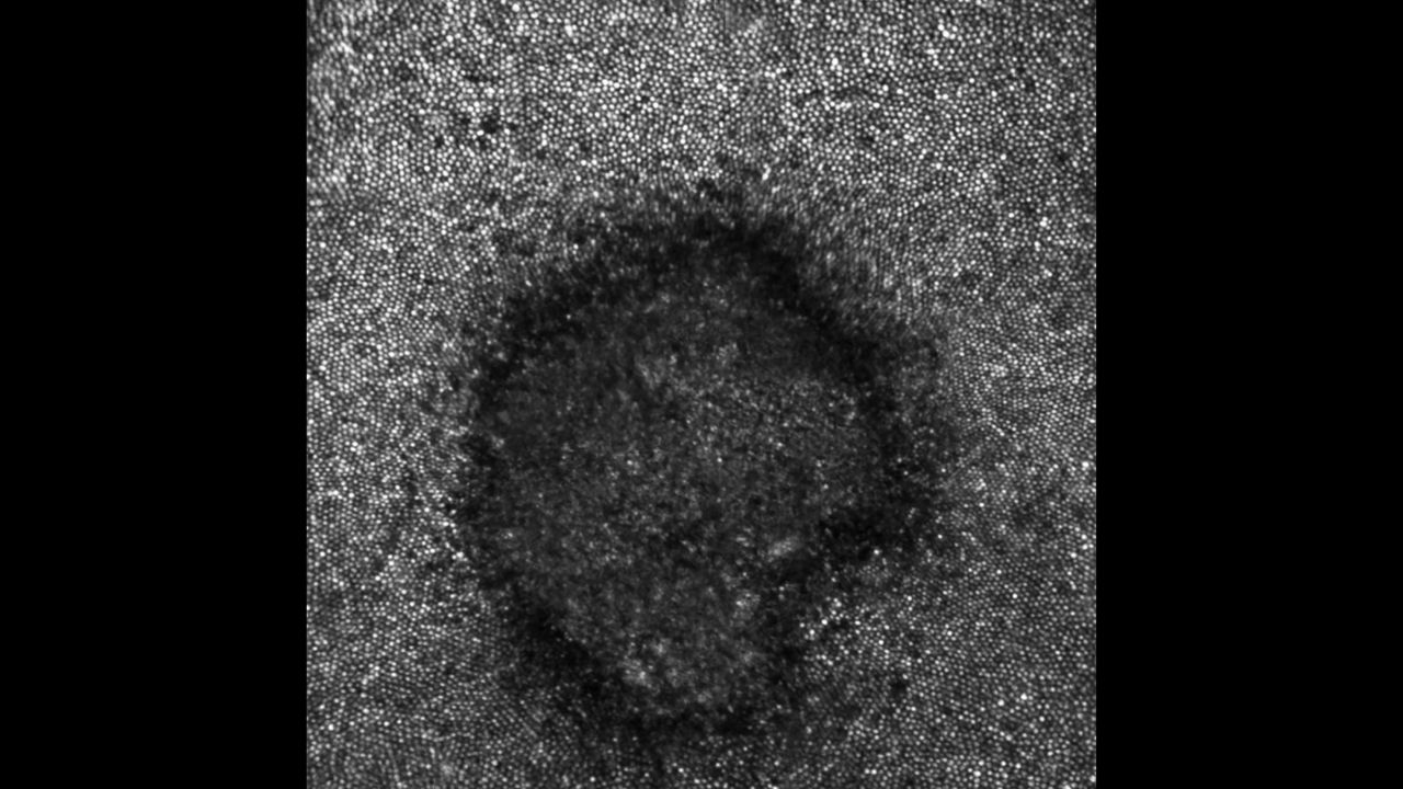 The adaptive optics image of Payne's retina revealed a crescent shape.