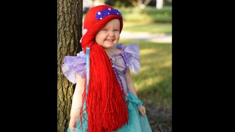 Violet is 2½ years old. Over the summer, she was diagnosed with acute lymphoblastic leukemia. Her mother discovered the Magic Yarn Project right as Violet was losing her hair. Now, she enjoys wearing an Ariel wig with her matching dress.