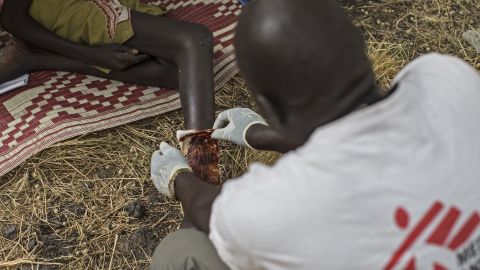 A girl is treated for a snake bite at a Medecins Sans Frontieres (MSF) clinic in Leer County, South Sudan.