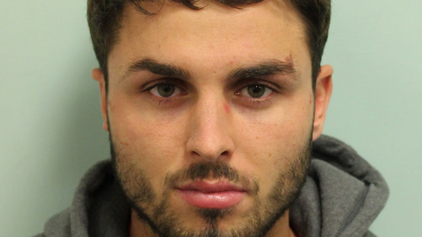 Acid attack perpetrator Arthur Collins who has been jailed for 20 years for an incident in a London nightclub in which 22 people were injured. 