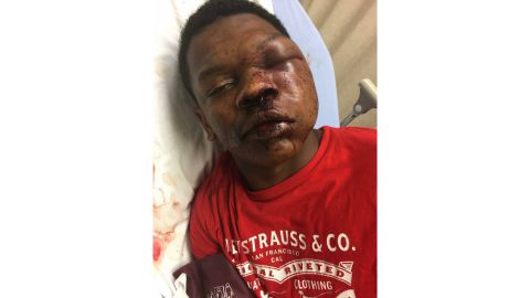 Ulysses Wilkerson, 17, was taken to the hospital after his arrest by Troy, Alabama, police.