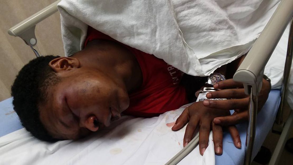 Ulysses Wilkerson, 17, was handcuffed to a gurney at a Birmingham hospital, his father says.