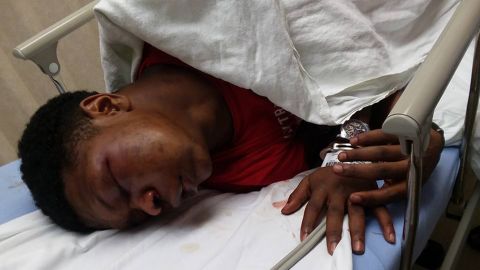 Ulysses Wilkerson, 17, was handcuffed to a gurney at a Birmingham hospital, his father says.