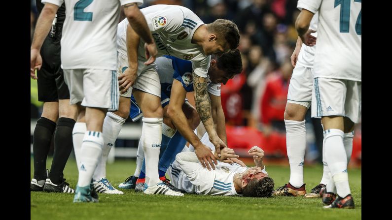 After scoring for Real Madrid, Cristiano Ronaldo suffers a kick to the face by opposing defender, Fabian Schar, in the 84th minute on Sunday, January 21, in Madrid, Spain.