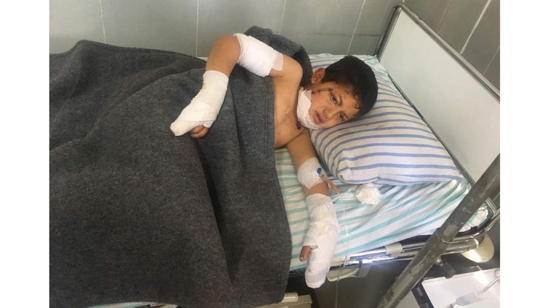 A child rests after being treated in Avrin Hospital in Afrin. 