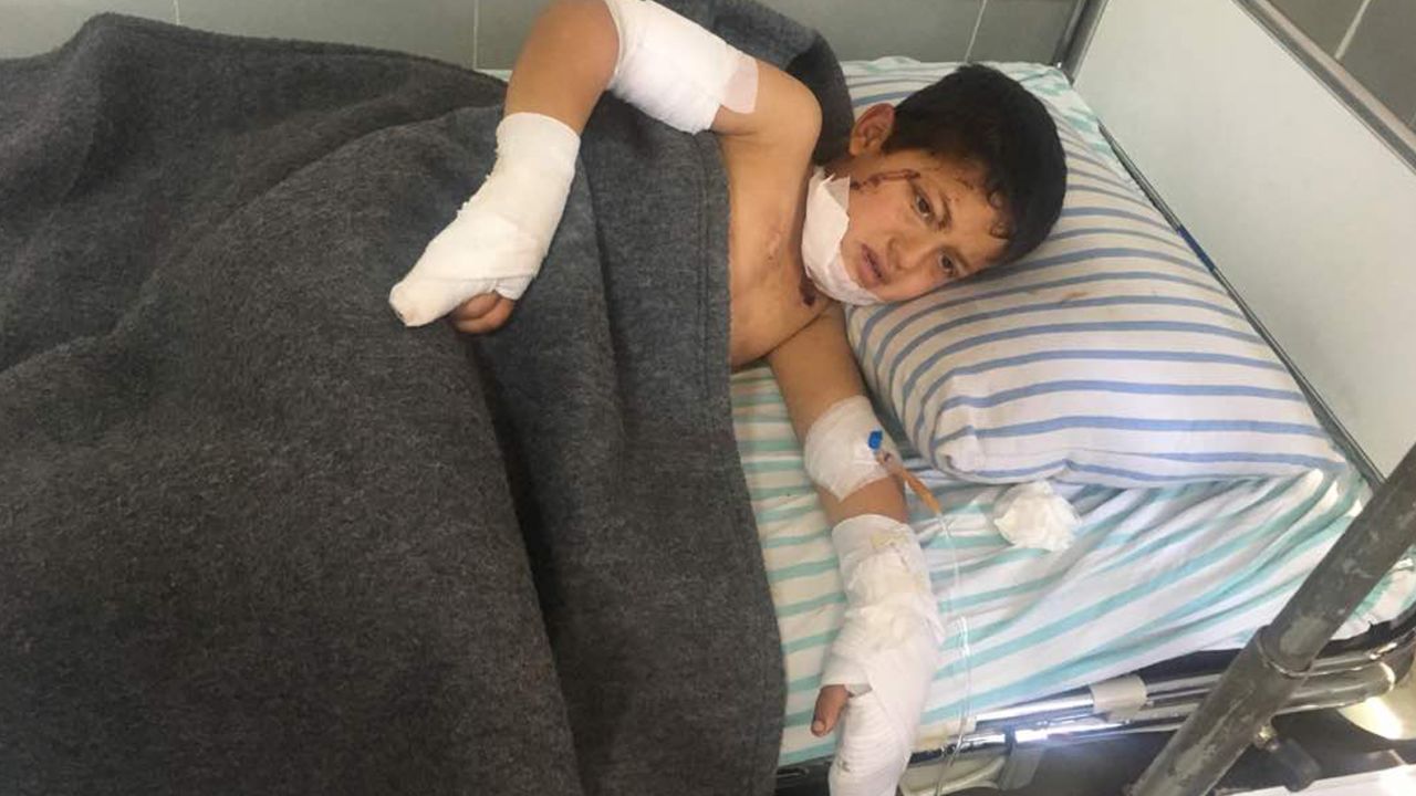 A child rests after being treated in Avrin Hospital in Afrin.