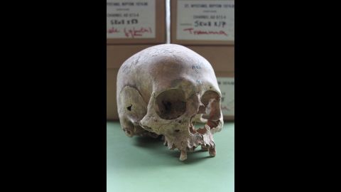 Researchers hope to learn more from the bones uncovered at Repton.