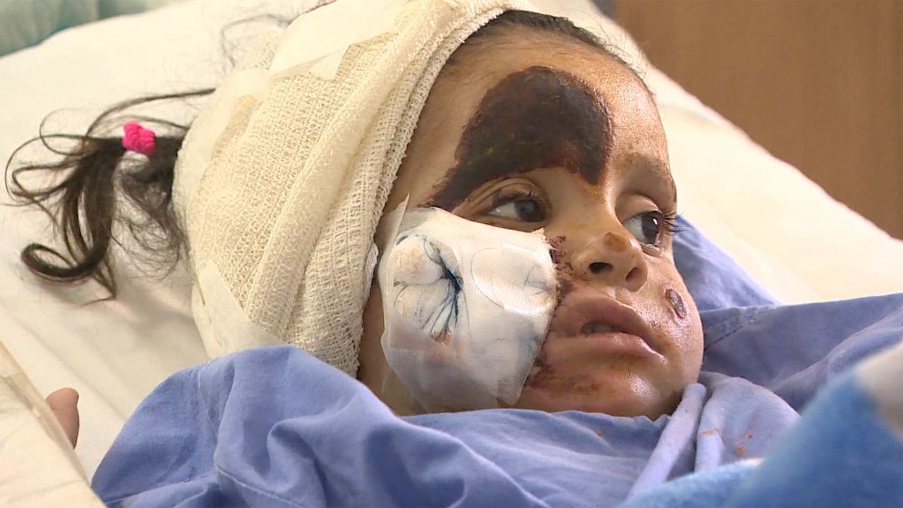 Sarah, 3, suffers from frostbite after smugglers abandoned her and her family as they were crossing into Lebanon.