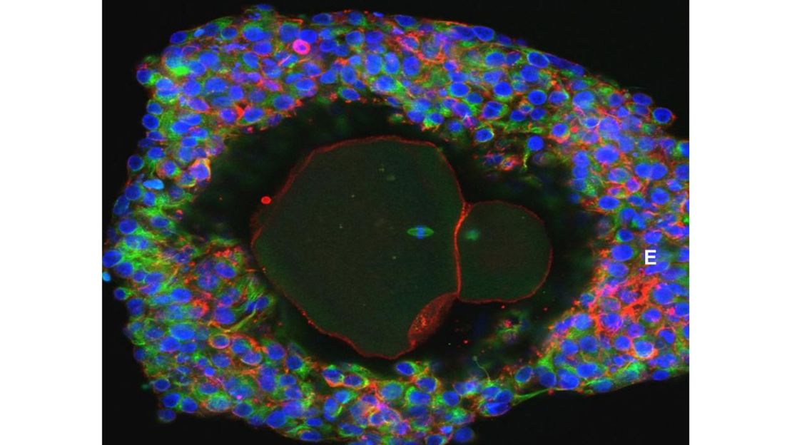 Magnification of a lab-grown mature human egg ready for fertilization.