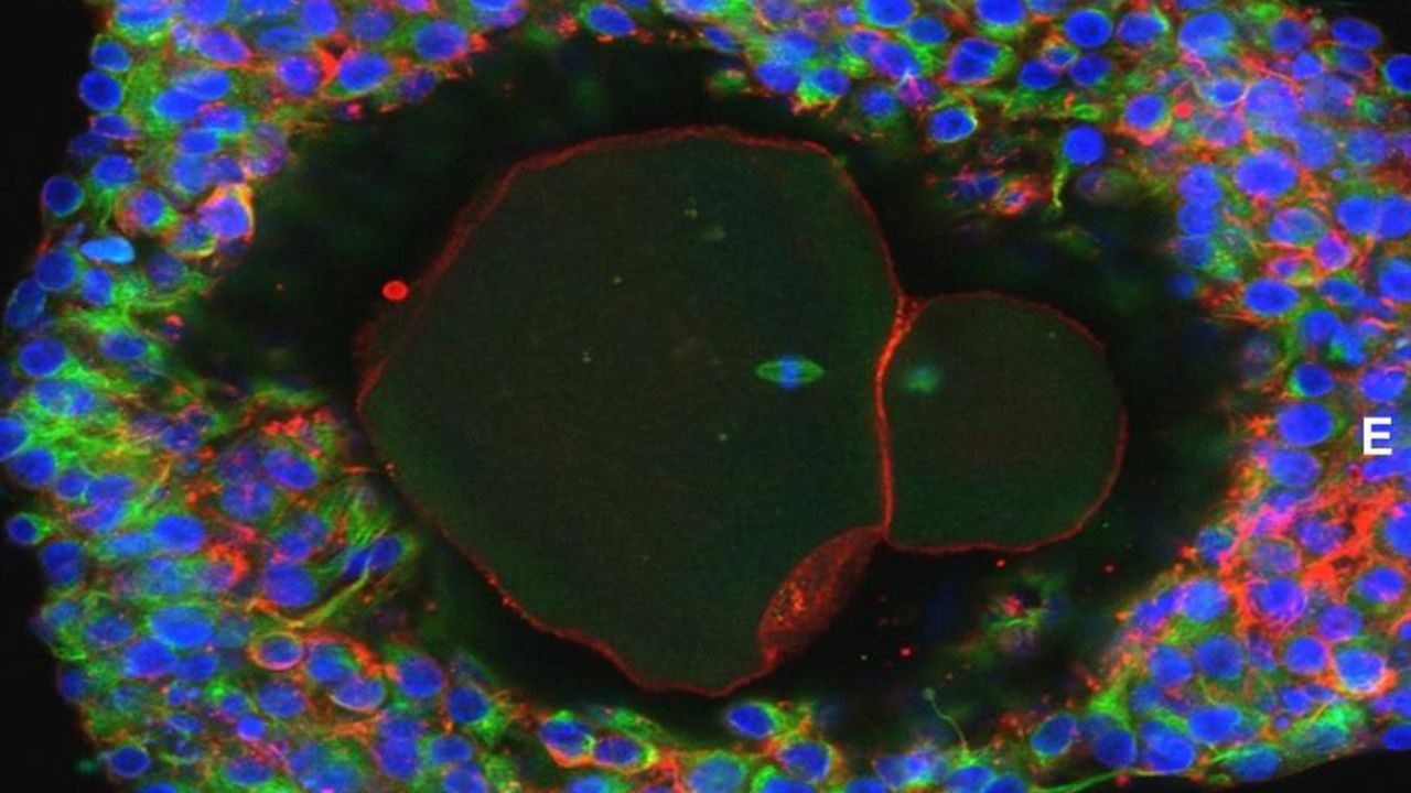 Magnification of a lab-grown mature human egg ready for fertilization.