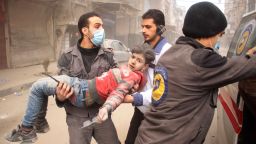 Members of Syrian Civil Defence carry an injured child following regime air strikes on the rebel-held besieged town of Douma in the eastern Ghouta region, on the outskirts of the capital Damascus, on February 7, 2018. / AFP PHOTO / Hamza Al-Ajweh        (Photo credit should read HAMZA AL-AJWEH/AFP/Getty Images)
