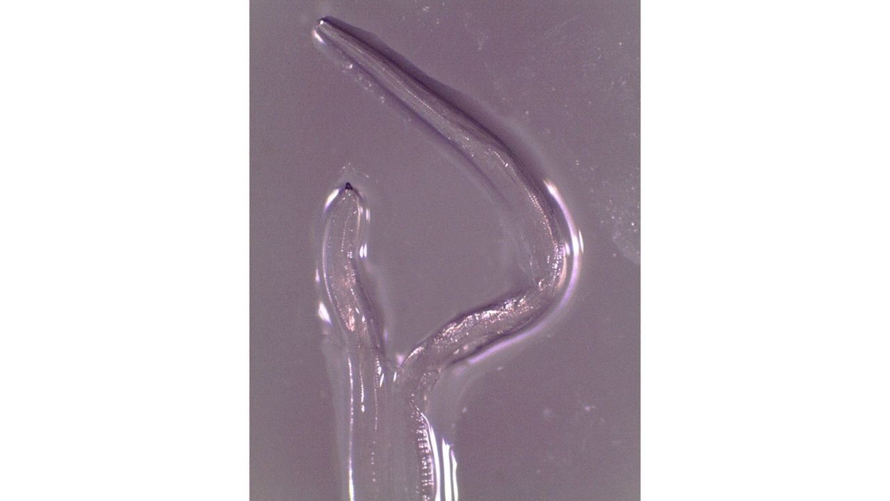 An adult female immediately after removal from the eye.