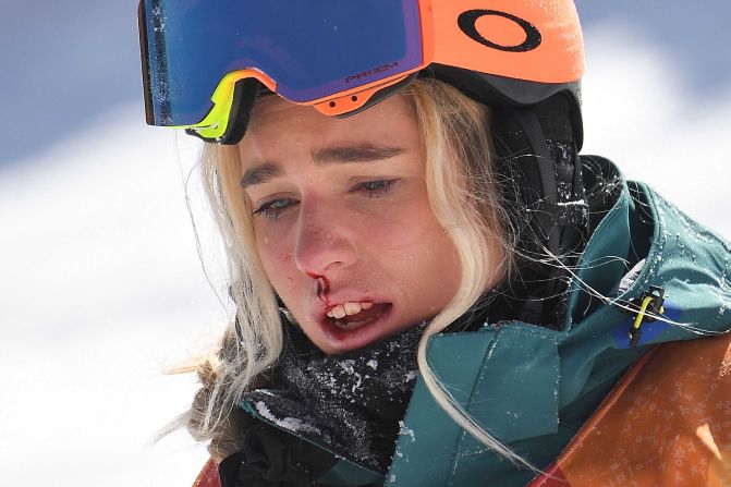 Australian snowboarder Emily Arthur bleeds from her nose after falling during a halfpipe run.