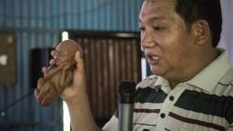 Soman Rai, a pastor who founded the non-profit Voice of Fetus Nepal, holds up a model of a fetus during a presentation about why women shouldn't have abortions because it is killing a fetus, at a small church in the village of Shilaprabat, Sindhupalcholk district, Nepal, July 14, 2017. Rai goes around the country giving pro-life presentations in churches, schools and other meeting venues, trying to convince people that abortion in killing a baby. The Sindhulpakcholk region was devastated by the 2015 earthquake in Nepal. Since that time, the Christian population has grown in size in those areas, which some attribute to Christian NGOs helping in the aftermath of the earthquake, and also to the fact the many people were looking for spiritual answers to make sense of their losses. 