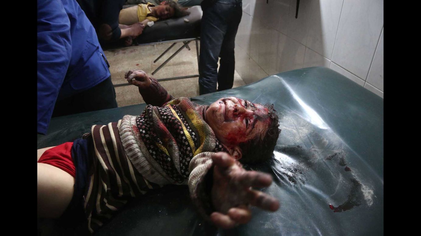 An injured child cries as he receives treatment at a makeshift hospital in Hamouria on February 19.