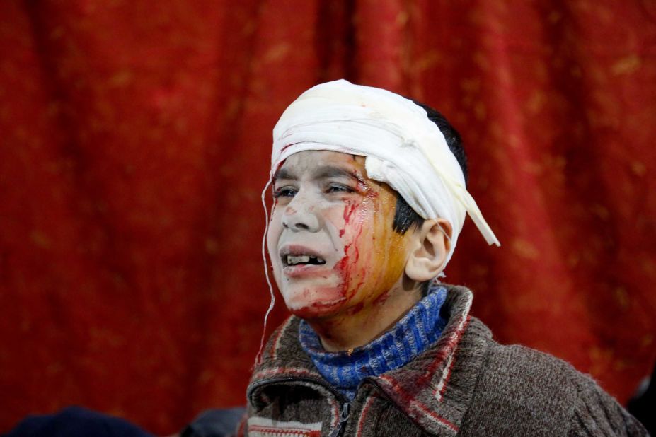 A boy waits to receive medical treatment at a field hospital on February 19.